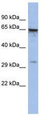 Melanoma-associated antigen 9 antibody, TA343532, Origene, Western Blot image 