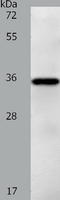 Phospholipid Phosphatase Related 5 antibody, TA323362, Origene, Western Blot image 