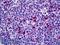Class II Major Histocompatibility Complex Transactivator antibody, LS-B5490, Lifespan Biosciences, Immunohistochemistry frozen image 