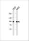 Interleukin 4 Receptor antibody, A00807-3, Boster Biological Technology, Western Blot image 