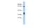 S100P Binding Protein antibody, PA5-44508, Invitrogen Antibodies, Western Blot image 