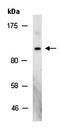 Zinc fingers and homeoboxes protein 2 antibody, orb66919, Biorbyt, Western Blot image 