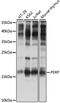 P53 Apoptosis Effector Related To PMP22 antibody, LS-C750471, Lifespan Biosciences, Western Blot image 
