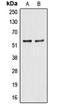 Aldehyde dehydrogenase, mitochondrial antibody, orb213547, Biorbyt, Western Blot image 