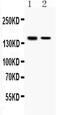 Scaffold attachment factor B1 antibody, PA5-79952, Invitrogen Antibodies, Western Blot image 