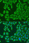 ATP Binding Cassette Subfamily F Member 2 antibody, 19-352, ProSci, Immunofluorescence image 