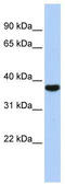 Exosome complex exonuclease RRP4 antibody, TA343806, Origene, Western Blot image 