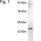 Secretory carrier-associated membrane protein 5 antibody, NB120-3432, Novus Biologicals, Western Blot image 