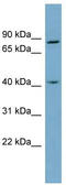 Zw10 Kinetochore Protein antibody, TA344367, Origene, Western Blot image 