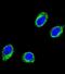 Coiled-Coil Alpha-Helical Rod Protein 1 antibody, abx033982, Abbexa, Immunocytochemistry image 