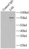 Lanosterol Synthase antibody, FNab04881, FineTest, Immunoprecipitation image 