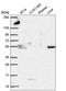 Alpha-L-Fucosidase 1 antibody, HPA056371, Atlas Antibodies, Western Blot image 
