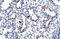 Hes Related Family BHLH Transcription Factor With YRPW Motif 1 antibody, ARP32512_P050, Aviva Systems Biology, Immunohistochemistry paraffin image 