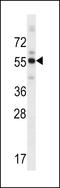 Zinc Finger And BTB Domain Containing 8B antibody, LS-C160730, Lifespan Biosciences, Western Blot image 