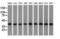 ACAT2 antibody, NBP2-02588, Novus Biologicals, Western Blot image 