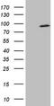 SMAD Specific E3 Ubiquitin Protein Ligase 2 antibody, M02585-2, Boster Biological Technology, Western Blot image 