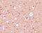 Amyloid Beta Precursor Protein Binding Family A Member 2 antibody, 6039, ProSci, Immunohistochemistry paraffin image 