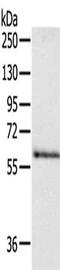 Dihydropyrimidinase-related protein 5 antibody, CSB-PA114925, Cusabio, Western Blot image 