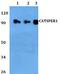 Cation Channel Sperm Associated 1 antibody, A04156, Boster Biological Technology, Western Blot image 