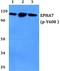 LYN Proto-Oncogene, Src Family Tyrosine Kinase antibody, A01424Y192, Boster Biological Technology, Western Blot image 