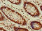 Vasohibin 2 antibody, LS-C679971, Lifespan Biosciences, Immunohistochemistry paraffin image 