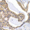 Prostaglandin I2 Receptor antibody, LS-C331727, Lifespan Biosciences, Immunohistochemistry paraffin image 