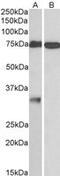 Glycoprotein M6A antibody, MBS422595, MyBioSource, Western Blot image 