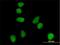 ATR Serine/Threonine Kinase antibody, H00000545-M01, Novus Biologicals, Immunofluorescence image 