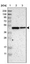 Lysophosphatidic Acid Receptor 3 antibody, NBP1-84903, Novus Biologicals, Western Blot image 