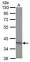 TRNA Methyltransferase 10A antibody, GTX121571, GeneTex, Western Blot image 