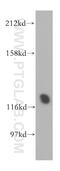 Phosphorylase Kinase Regulatory Subunit Beta antibody, 13400-1-AP, Proteintech Group, Western Blot image 