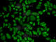 Aldehyde Dehydrogenase 2 Family Member antibody, A1226, ABclonal Technology, Immunofluorescence image 