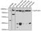 SPT20 Homolog, SAGA Complex Component antibody, GTX65918, GeneTex, Western Blot image 