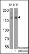 Nitric Oxide Synthase 1 antibody, PA1-032, Invitrogen Antibodies, Western Blot image 
