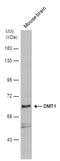 Nramp2 antibody, PA5-78404, Invitrogen Antibodies, Western Blot image 