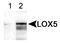 Arachidonate 5-lipoxygenase antibody, TA336527, Origene, Western Blot image 