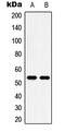5-Hydroxytryptamine Receptor 2B antibody, MBS820387, MyBioSource, Western Blot image 