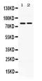 Autocrine Motility Factor Receptor antibody, PB10039, Boster Biological Technology, Western Blot image 