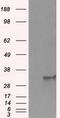 Fumarylacetoacetate Hydrolase Domain Containing 2A antibody, GTX84538, GeneTex, Western Blot image 