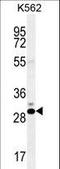 Cancer/Testis Antigen Family 45 Member A1 antibody, LS-C203655, Lifespan Biosciences, Western Blot image 