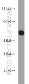 Aldehyde Dehydrogenase 2 Family Member antibody, 15310-1-AP, Proteintech Group, Western Blot image 