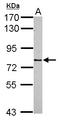 Lysine Acetyltransferase 14 antibody, LS-B11653, Lifespan Biosciences, Western Blot image 
