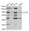 UDP Glucuronosyltransferase Family 1 Member A4 antibody, LS-C334128, Lifespan Biosciences, Western Blot image 