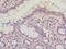 BLP antibody, A51253-100, Epigentek, Immunohistochemistry paraffin image 