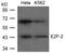 E2F Transcription Factor 2 antibody, GTX50837, GeneTex, Western Blot image 