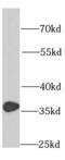Ribosomal Protein S3A antibody, FNab07478, FineTest, Western Blot image 