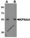 Karyopherin Subunit Alpha 4 antibody, 5987, ProSci, Western Blot image 