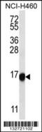 Uncharacterized protein CXorf1 antibody, 56-895, ProSci, Western Blot image 