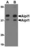 Aryl Hydrocarbon Receptor Interacting Protein Like 1 antibody, TA306669, Origene, Western Blot image 