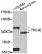 cAMP-specific 3 ,5 -cyclic phosphodiesterase 4D antibody, A1659, ABclonal Technology, Western Blot image 